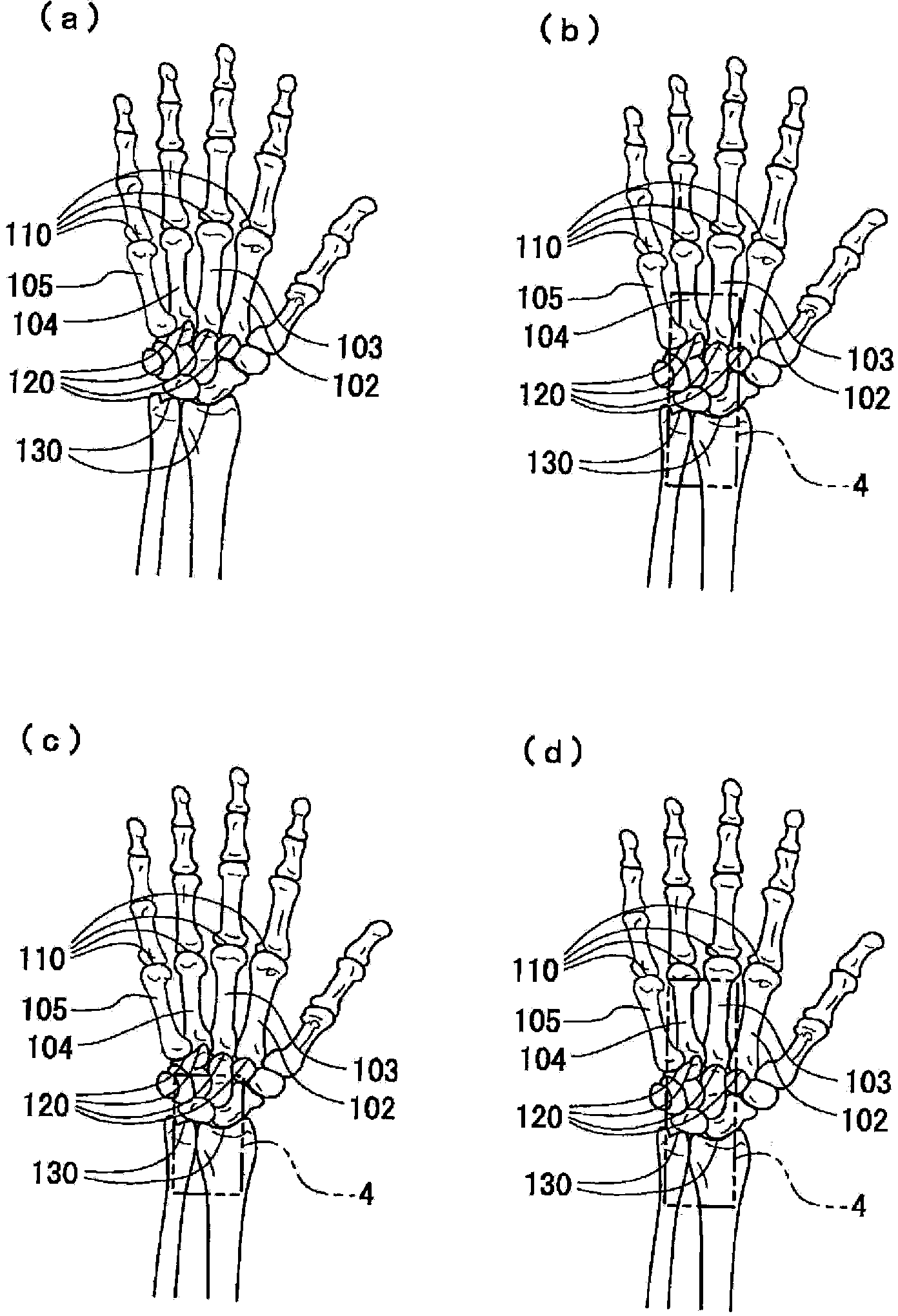 Hand joint supporter