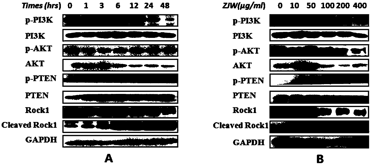 Regulating effect of zuojin wan (ZJW) on ROCK/PTEN/PI3K signal pathway of human gastric cancer drug-resistant cells and application of ZJW