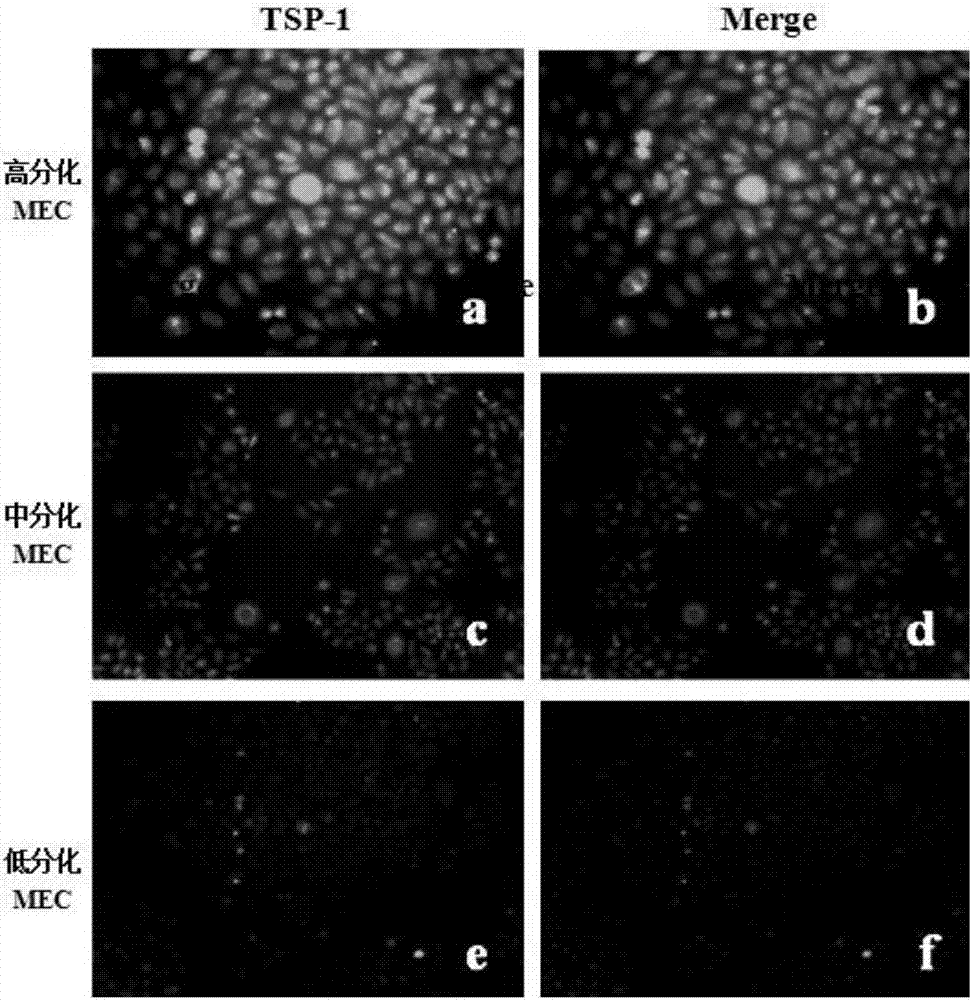 Animal models for in vivo screening biological macromolecules having influences on tumor cell biology