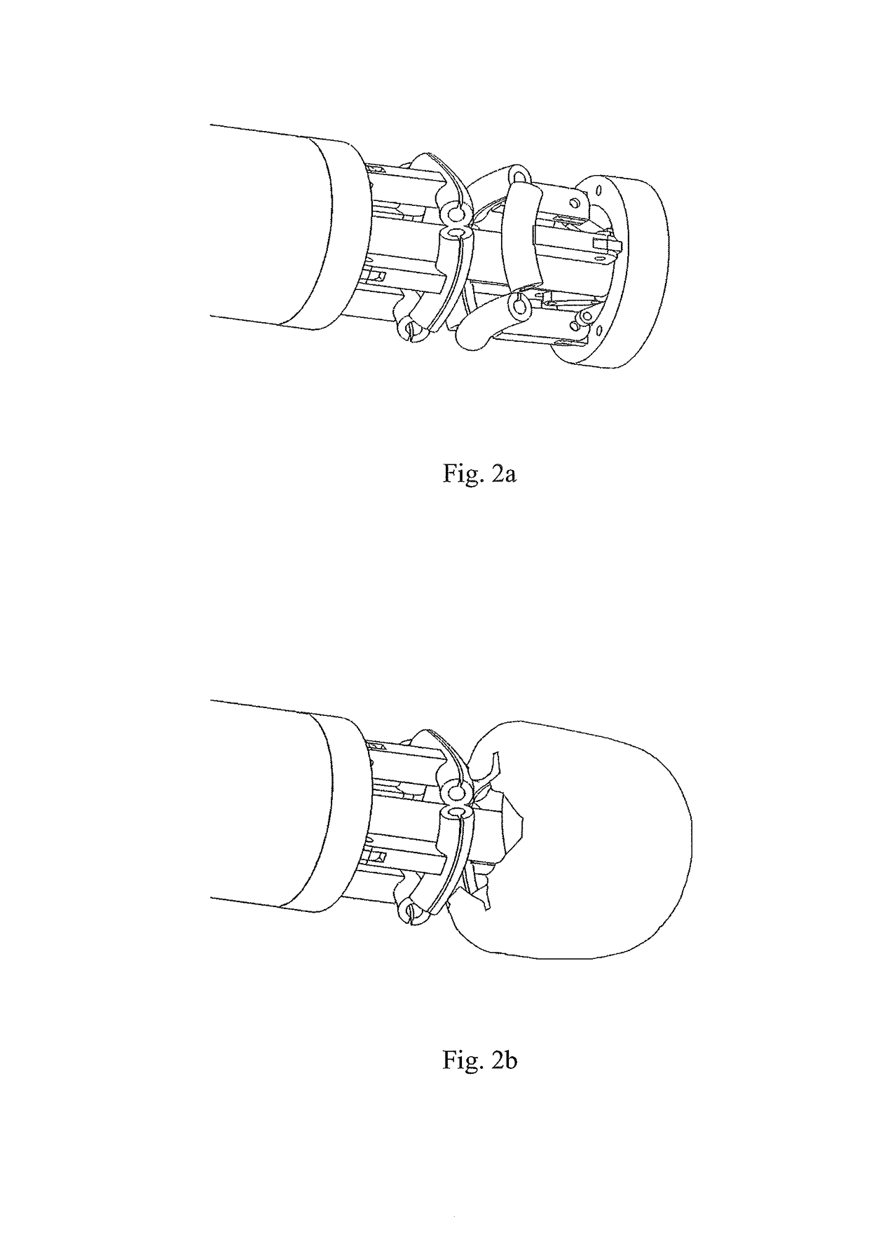 Device for percutaneous transcathertral closure of atrial septal defect by deploying pericardial patch