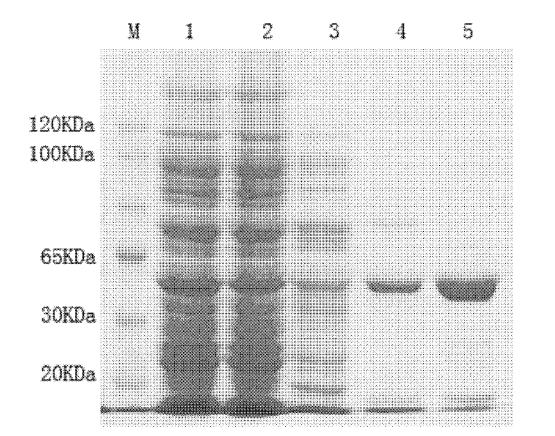 A kind of phytoene dehydrogenase gene and its application