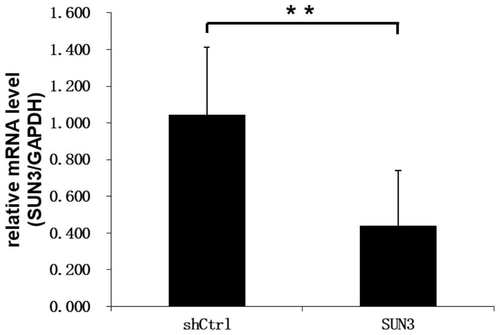 Application of human SUN3 gene and related products