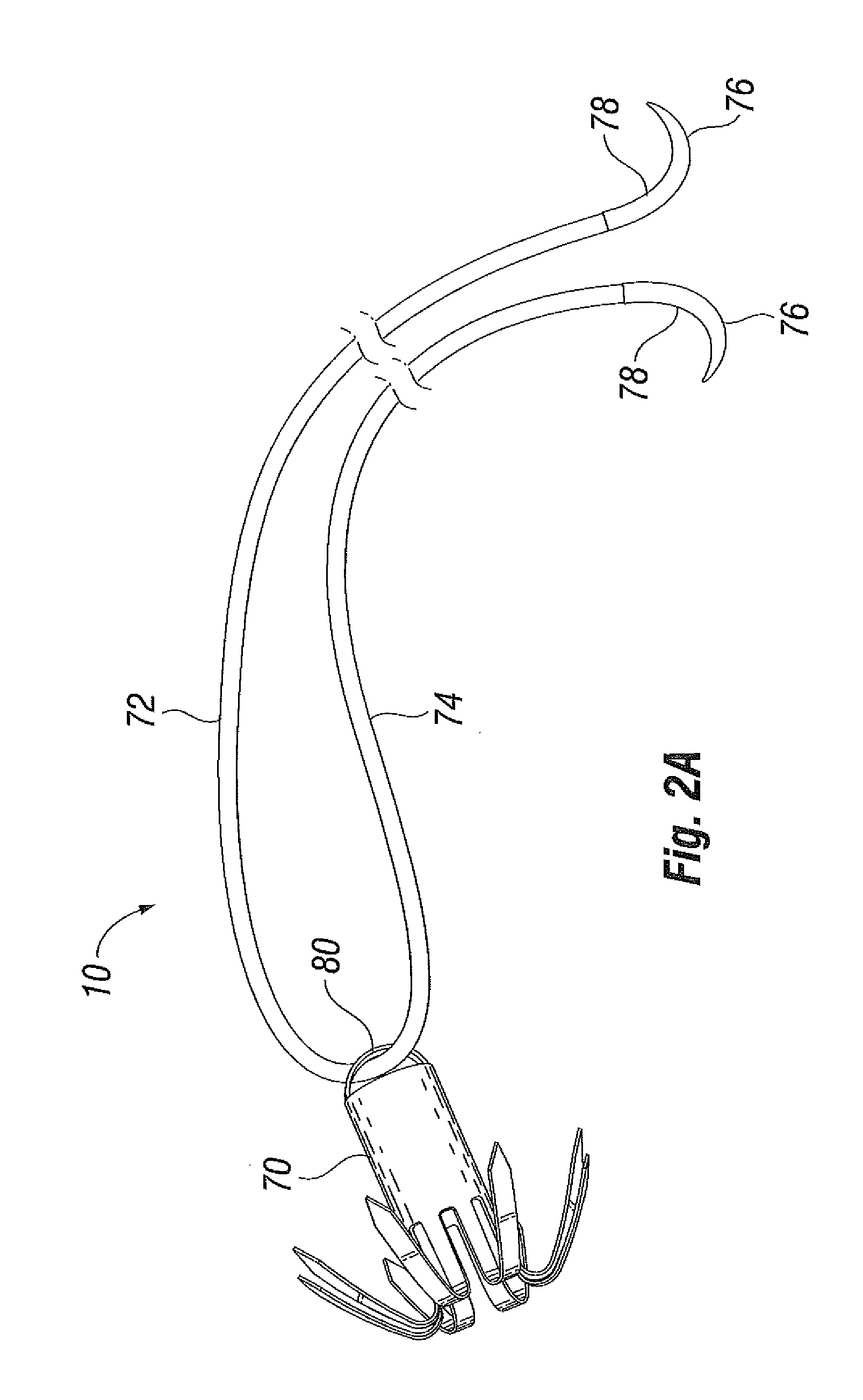 Suture and method for repairing a heart