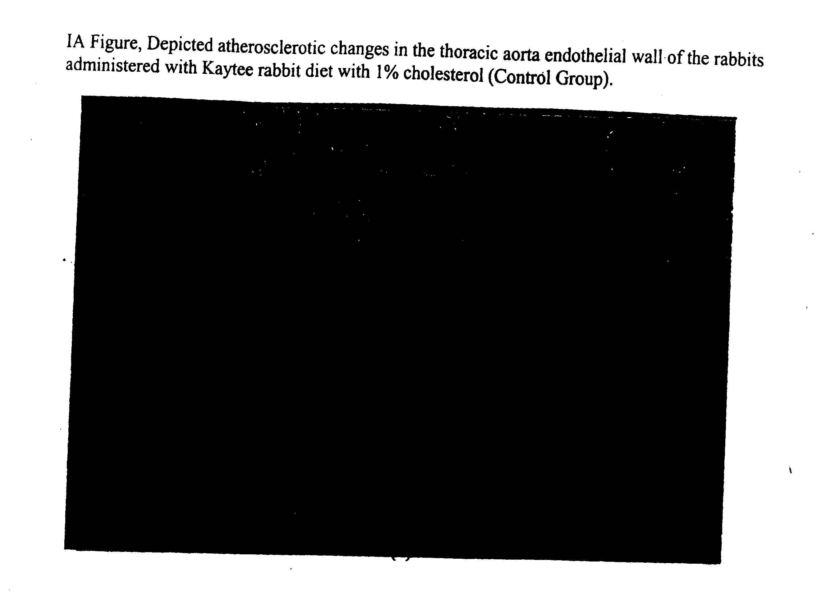 Method for preventing and/or treating the cardiovascular and hepatic diseases induced by hyperlipidemia which comprises administered an effective amount of bioflavonoids extract derived from fructus crataegus (lipid metabolism and fructus crataegus)