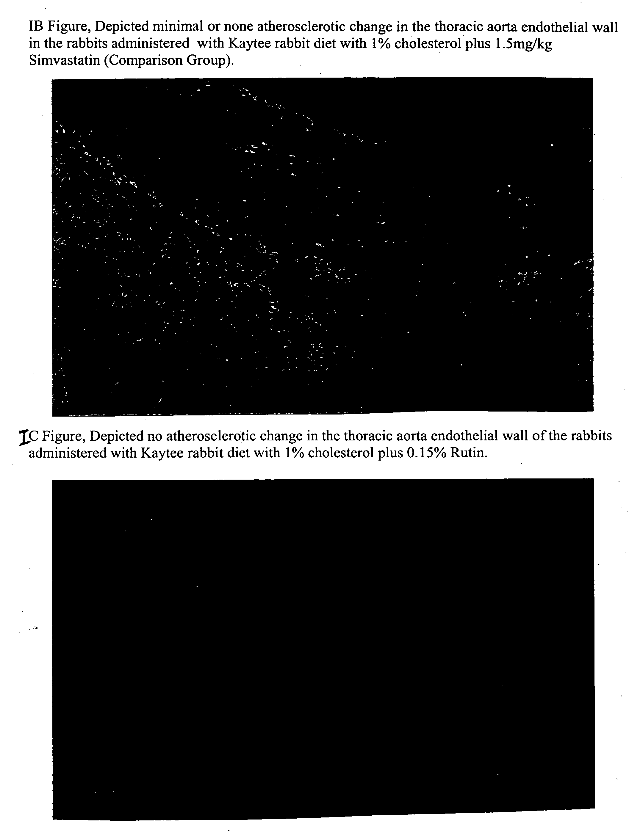 Method for preventing and/or treating the cardiovascular and hepatic diseases induced by hyperlipidemia which comprises administered an effective amount of bioflavonoids extract derived from fructus crataegus (lipid metabolism and fructus crataegus)