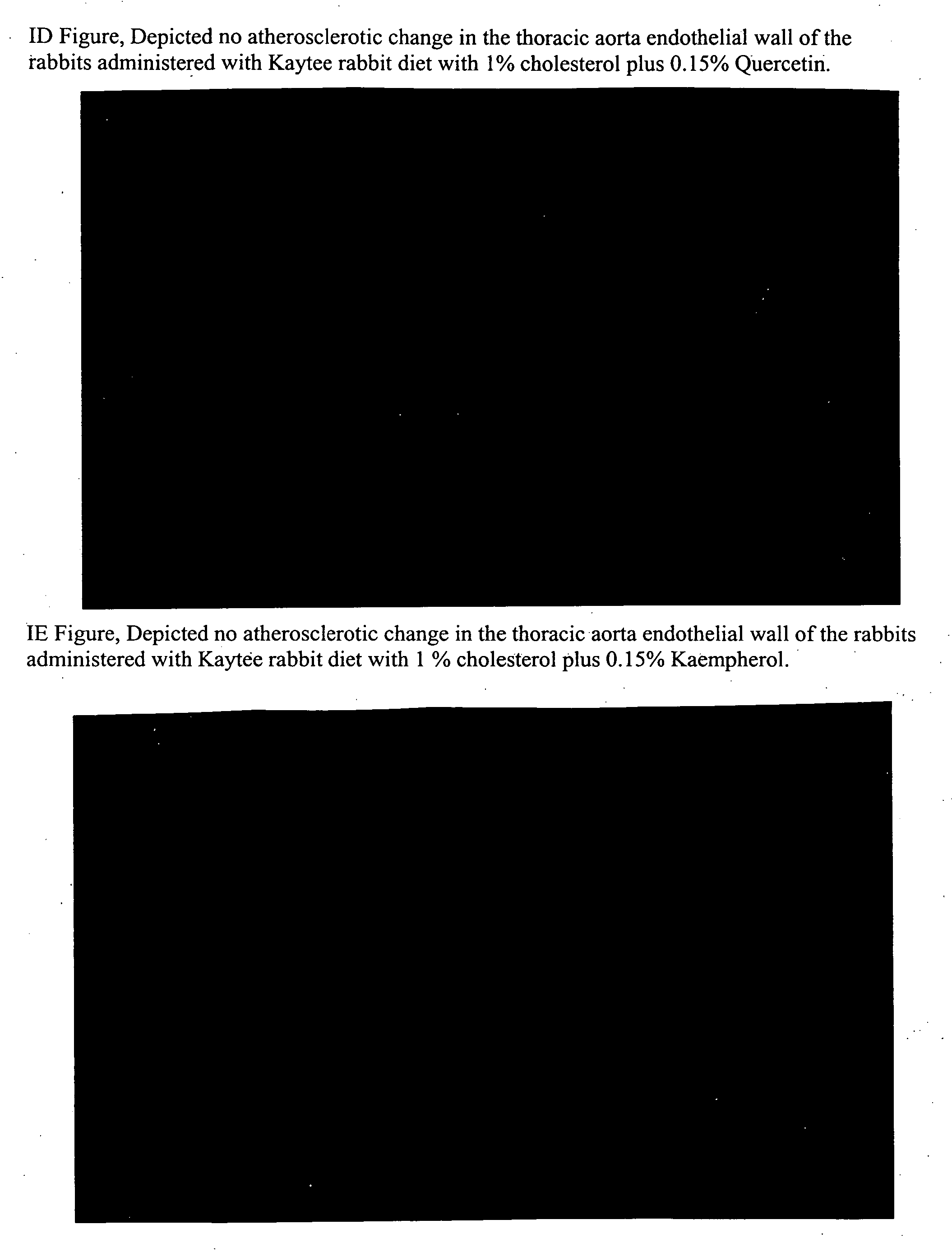 Method for preventing and/or treating the cardiovascular and hepatic diseases induced by hyperlipidemia which comprises administered an effective amount of bioflavonoids extract derived from fructus crataegus (lipid metabolism and fructus crataegus)