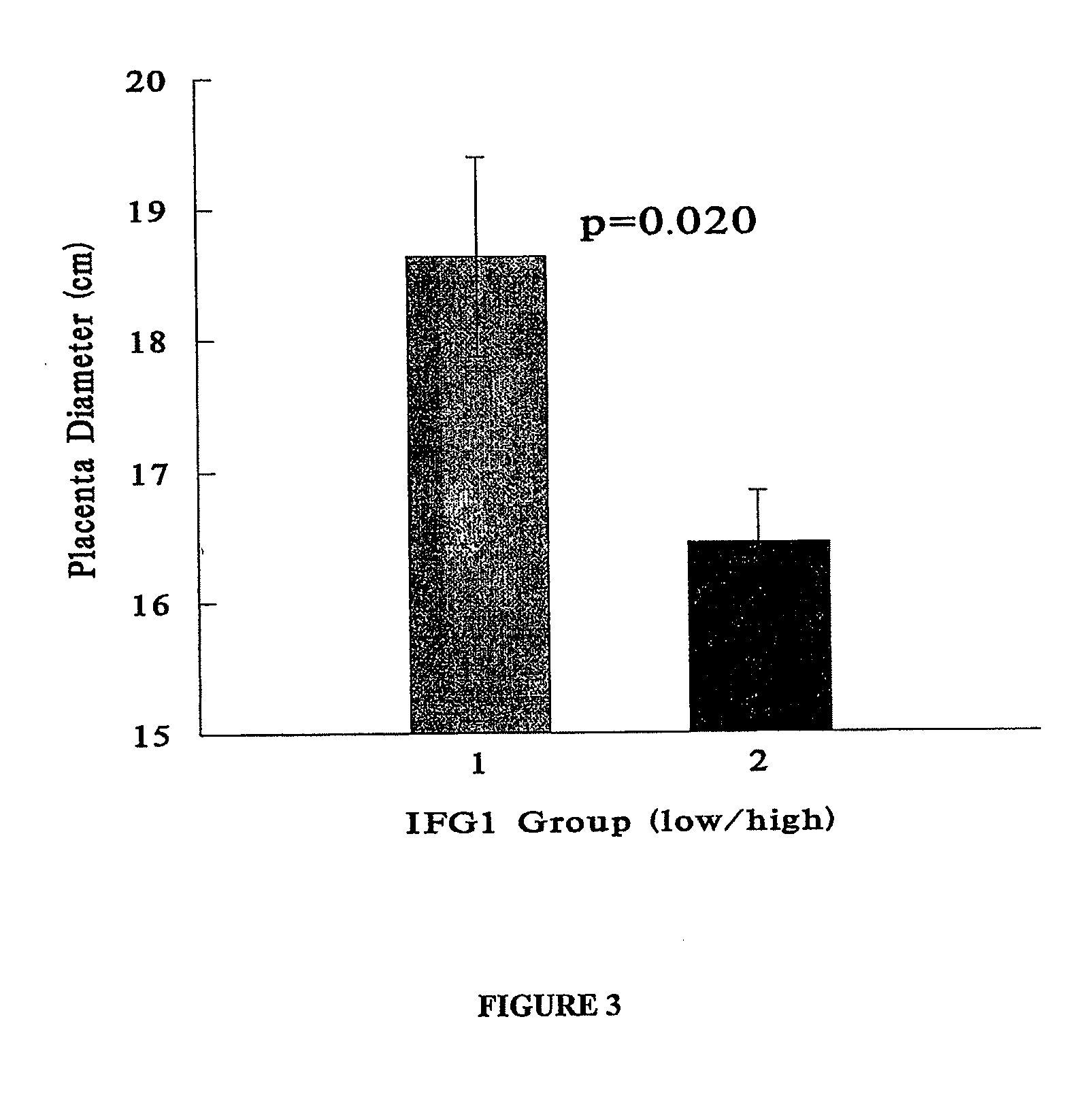 Genetic Markers Of True Low Birth Weight