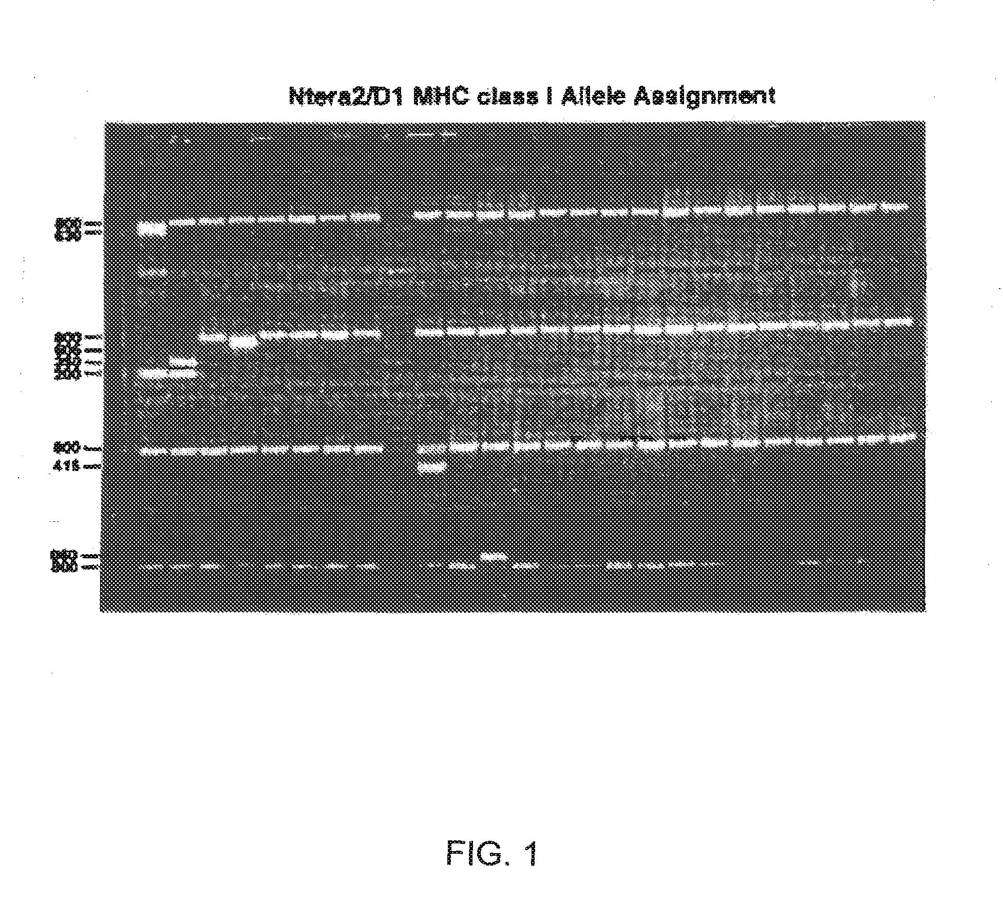 Human immunosuppressive protein