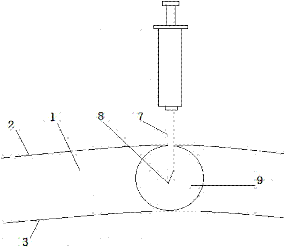 Myocardium ablation device