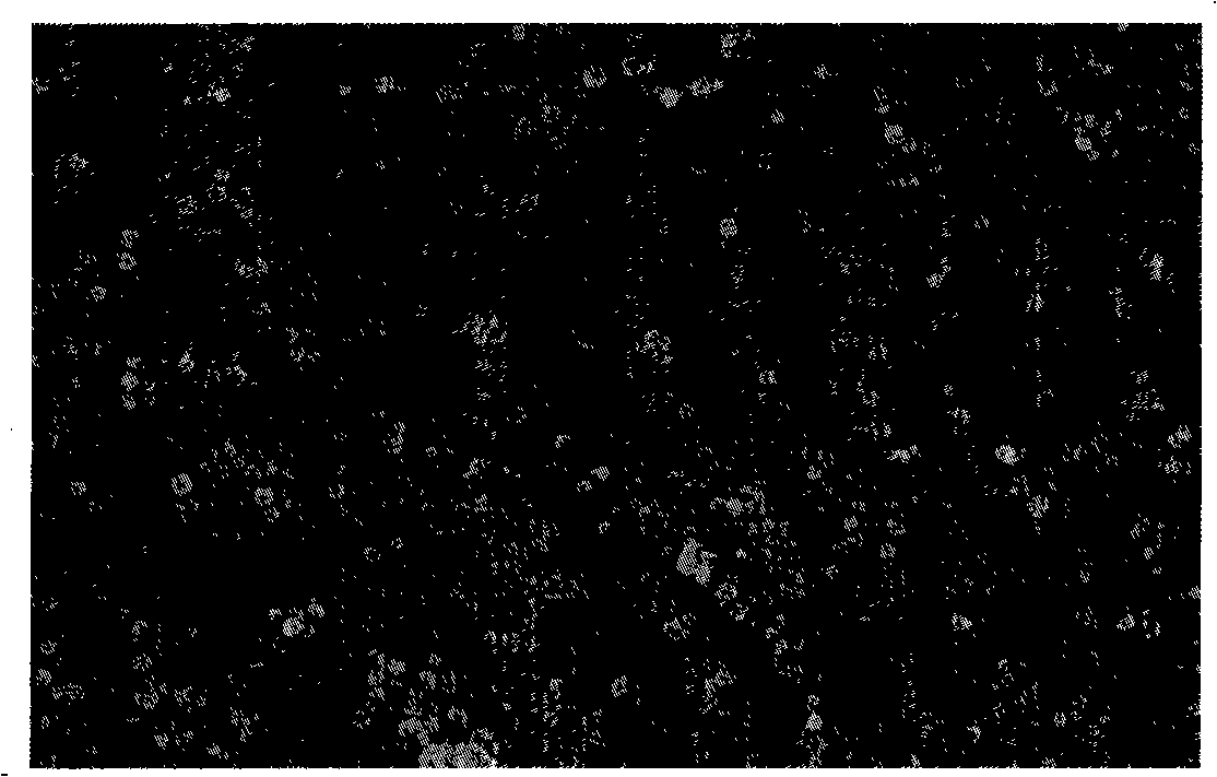 Implantation type antineoplastic drug of 10-hydroxycamptothecin dual-sustained-release particle formulation and preparation method thereof