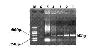 Visualized loop-mediated isothermal amplification kit for detecting Haemophilus parasuis