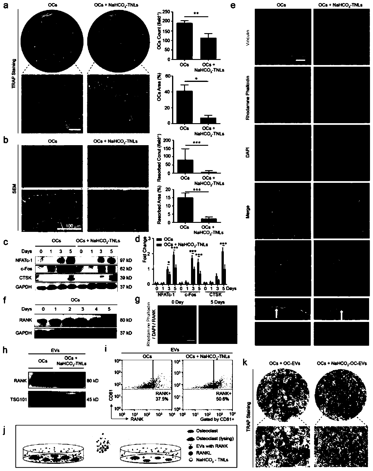 Nano material for osteoclast acidic closed region and preparation method thereof