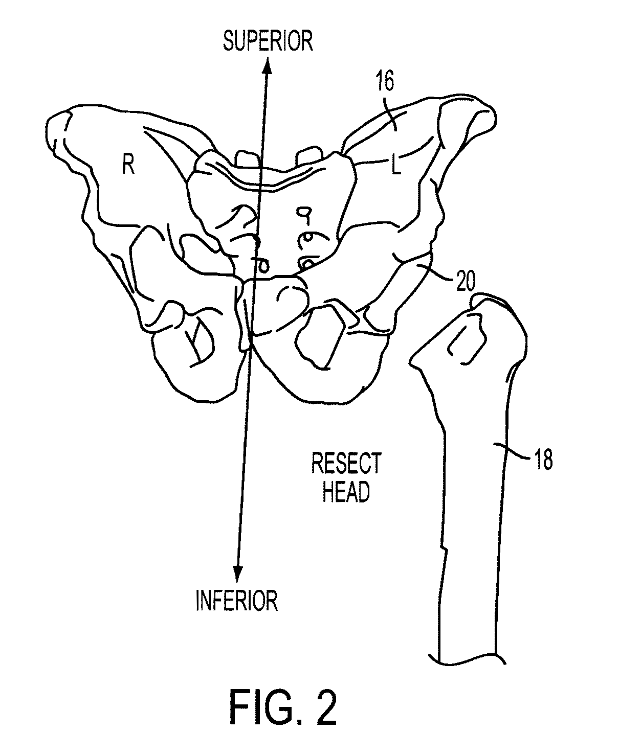 Universal double offset surgical instrument