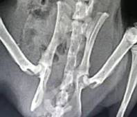 A compound acellular matrix injection for treating femoral head necrosis and using method