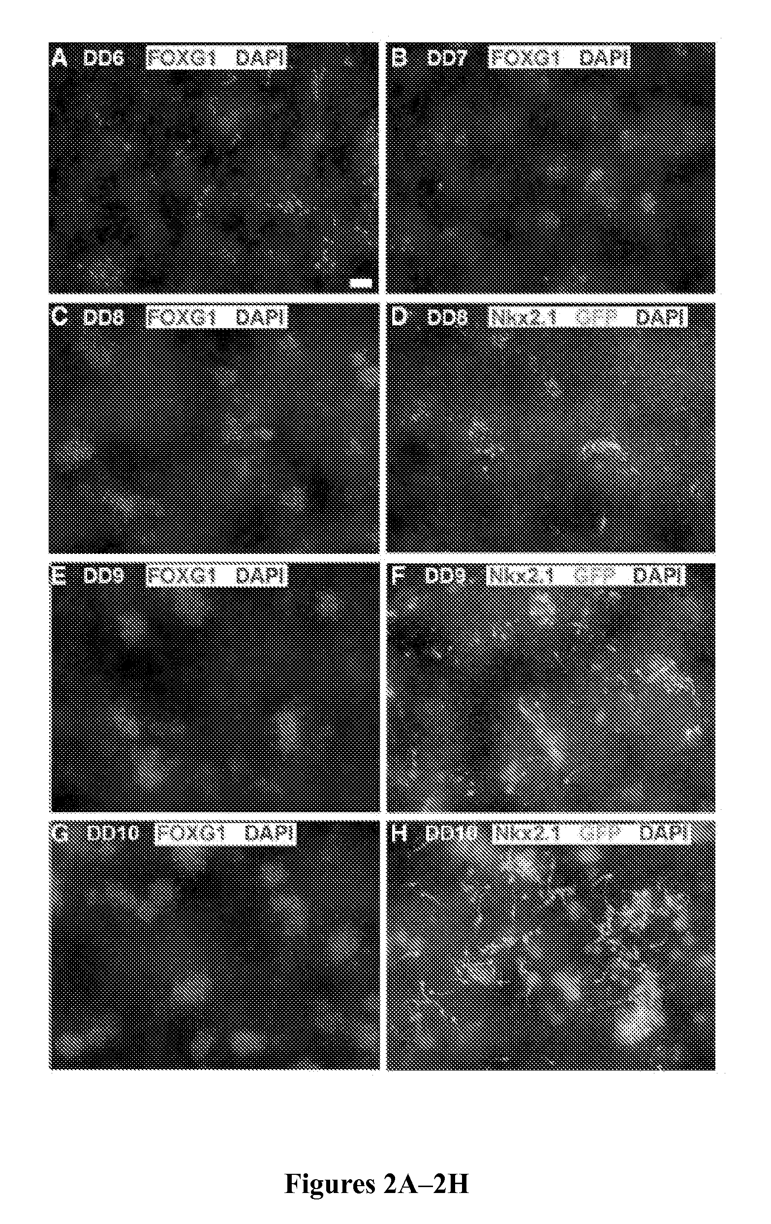 Method to isolate, identify, and use embryonic stem cells directed to forebrain interneuron fate