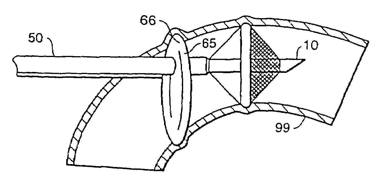 Aortic occluder with associated filter and methods of use during cardiac surgery