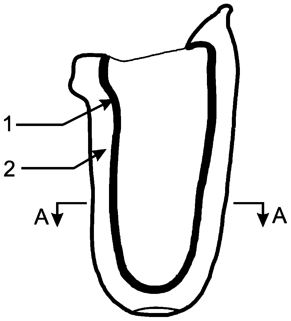 Prosthetic socket having deformation adjusting and controlling function and 4D printing forming method of prosthetic socket