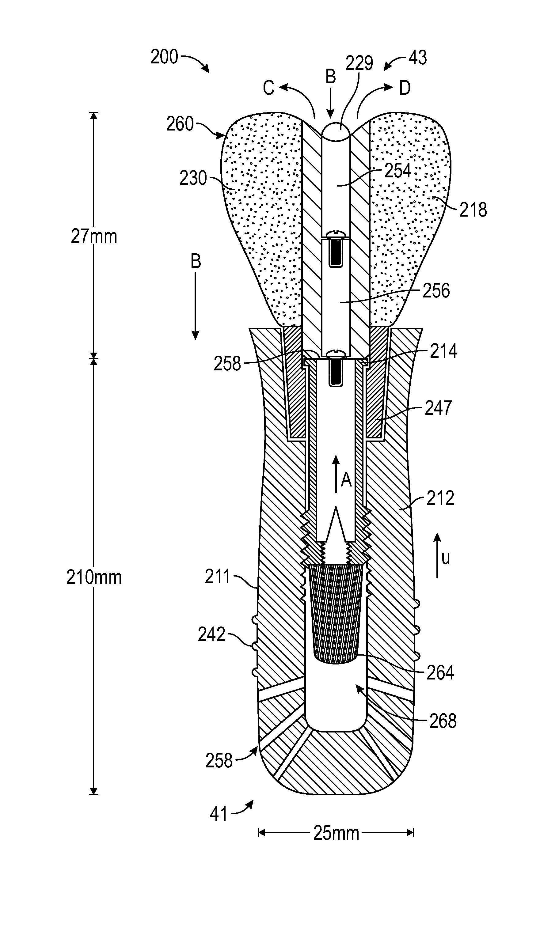 Artificial Salivary Gland