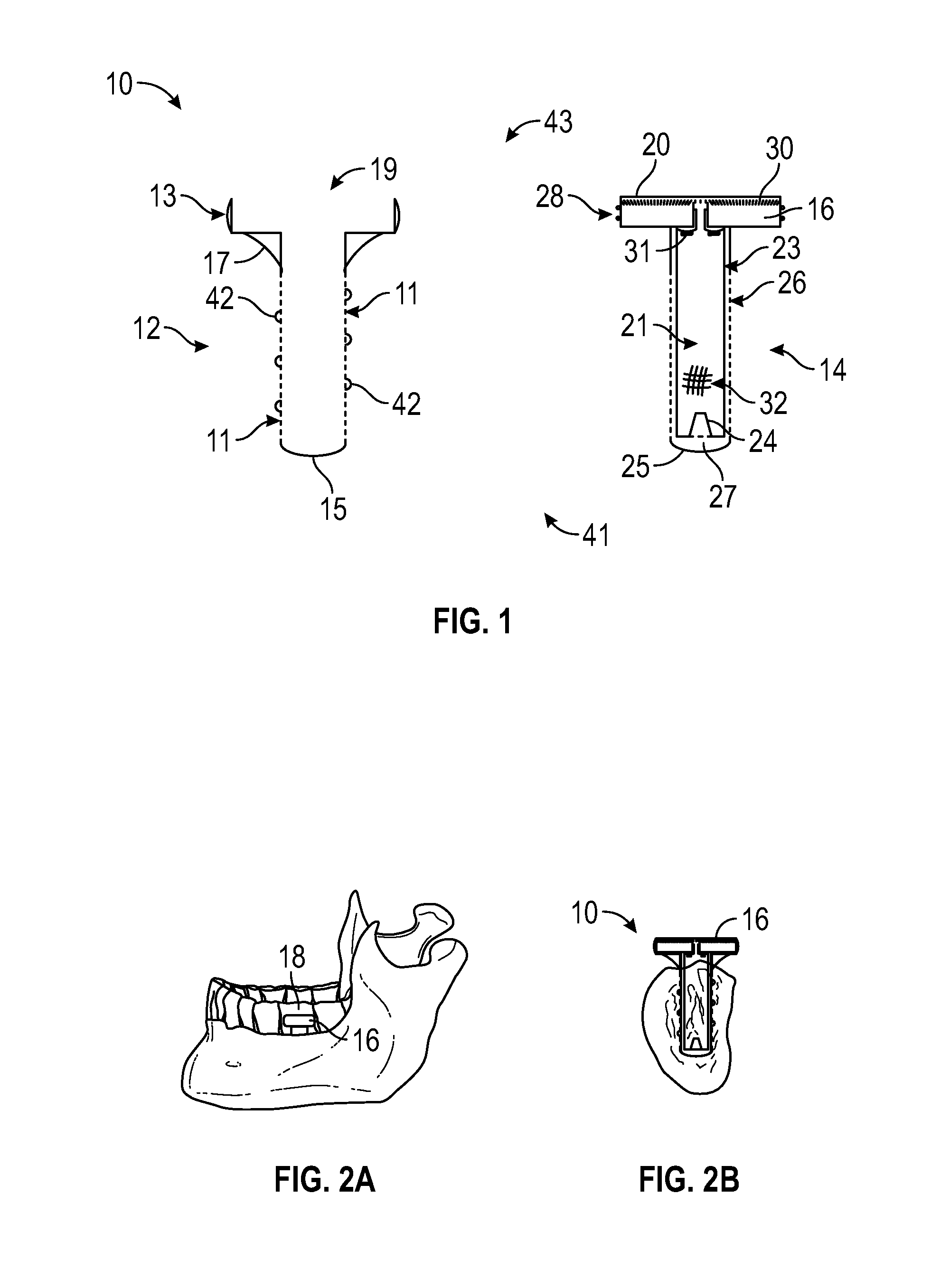 Artificial Salivary Gland