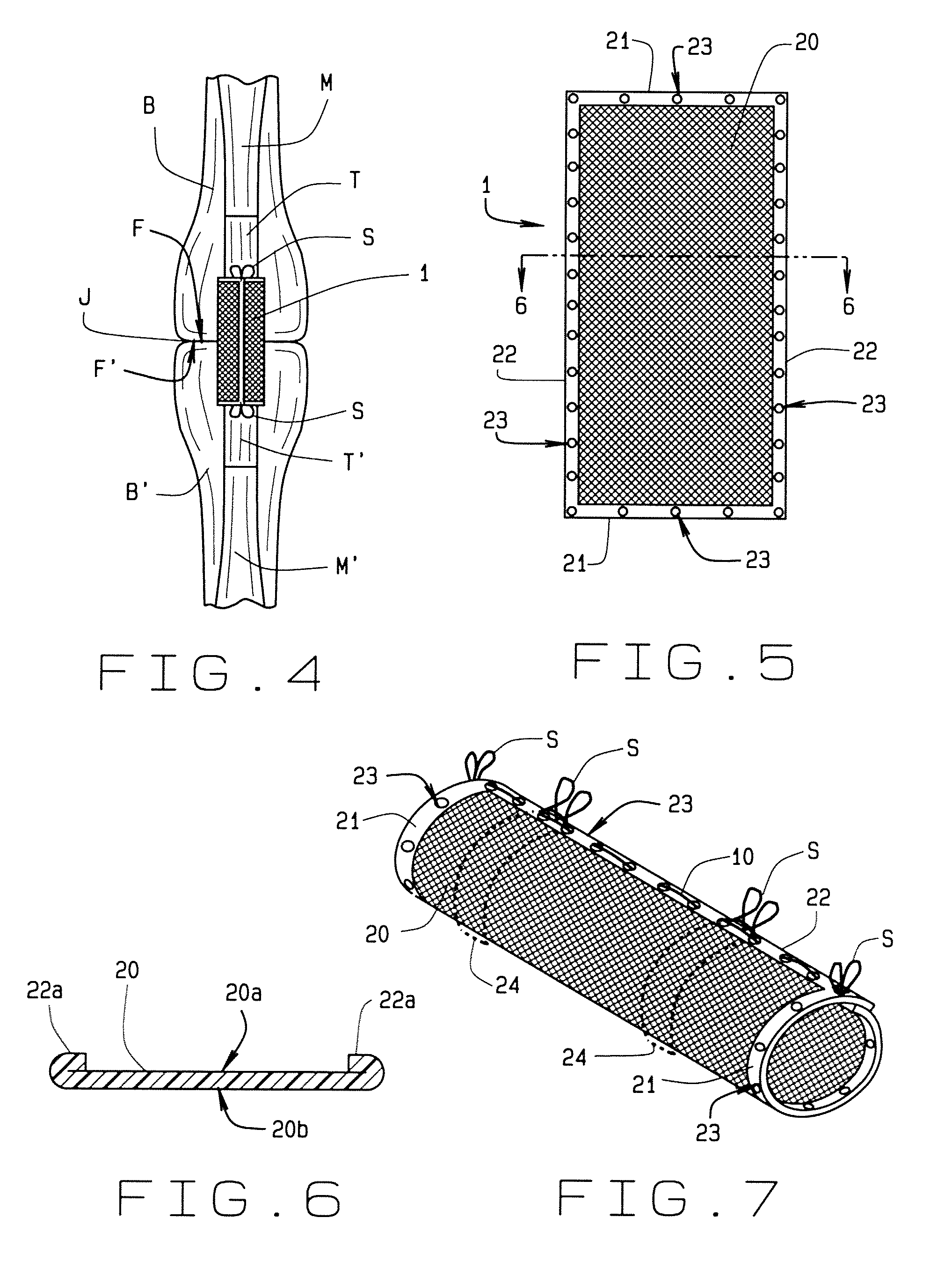 Terminal tissue attachment and repair device