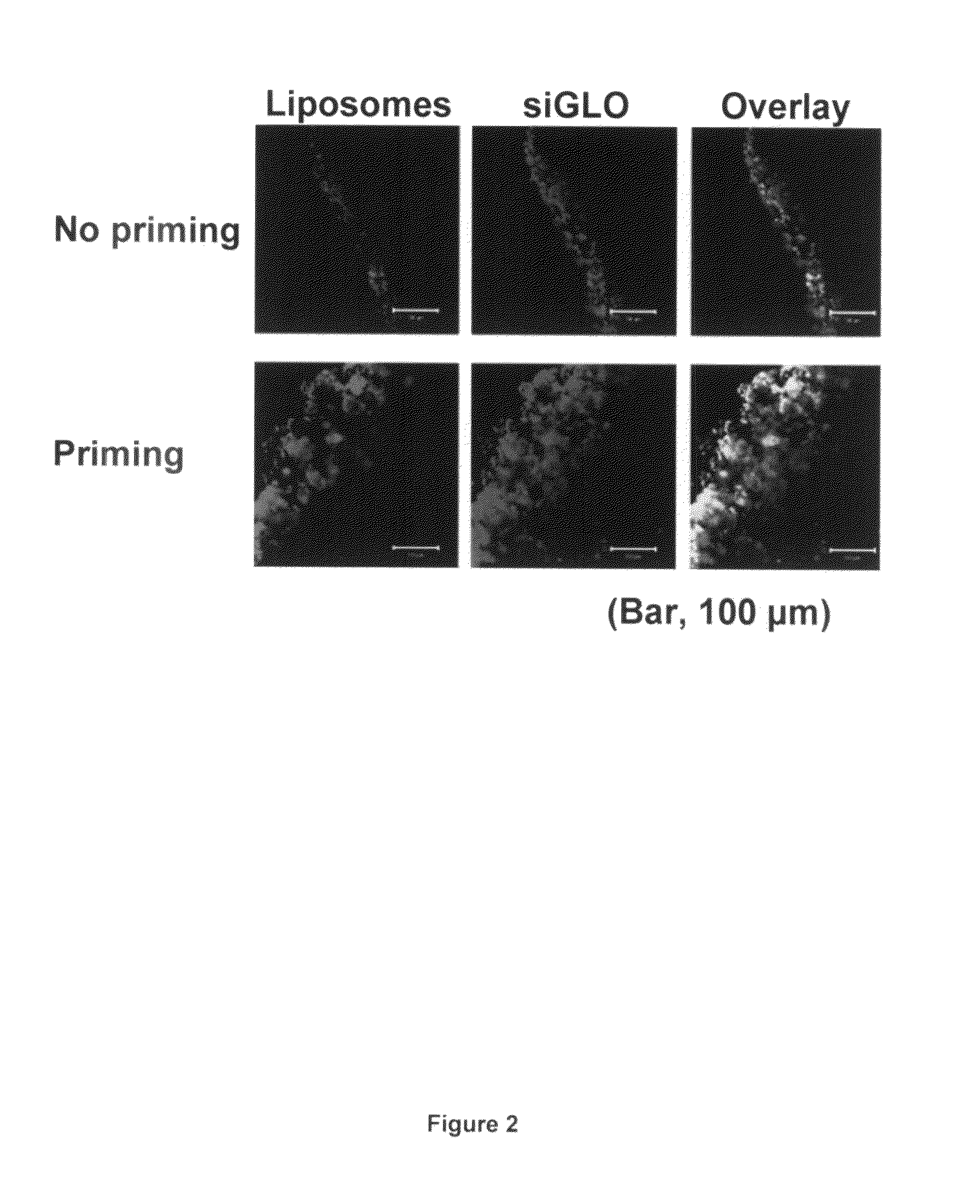 Tumor targeting drug-loaded particles