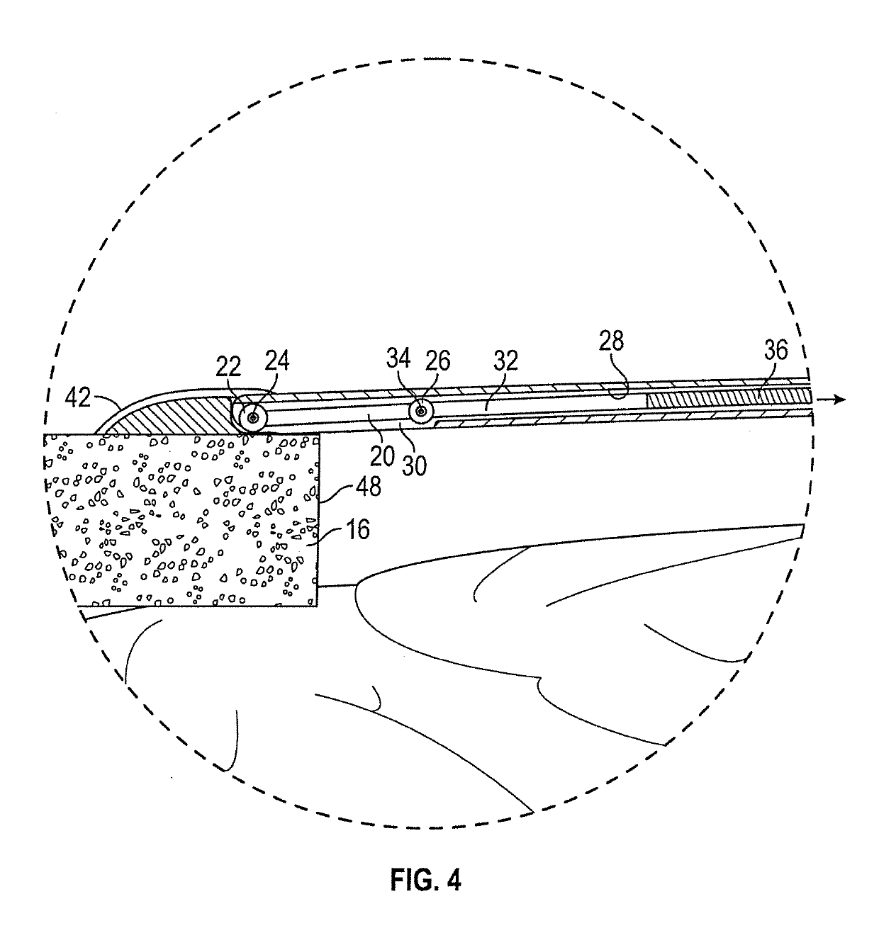 Cranioplasty Plate Assembly with Pivotal Struts