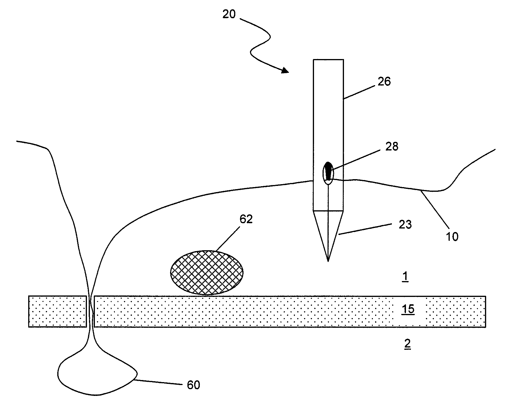 Suture passer with suture capturing articulating jaw at distal end for suturing in arthroscopic surgery