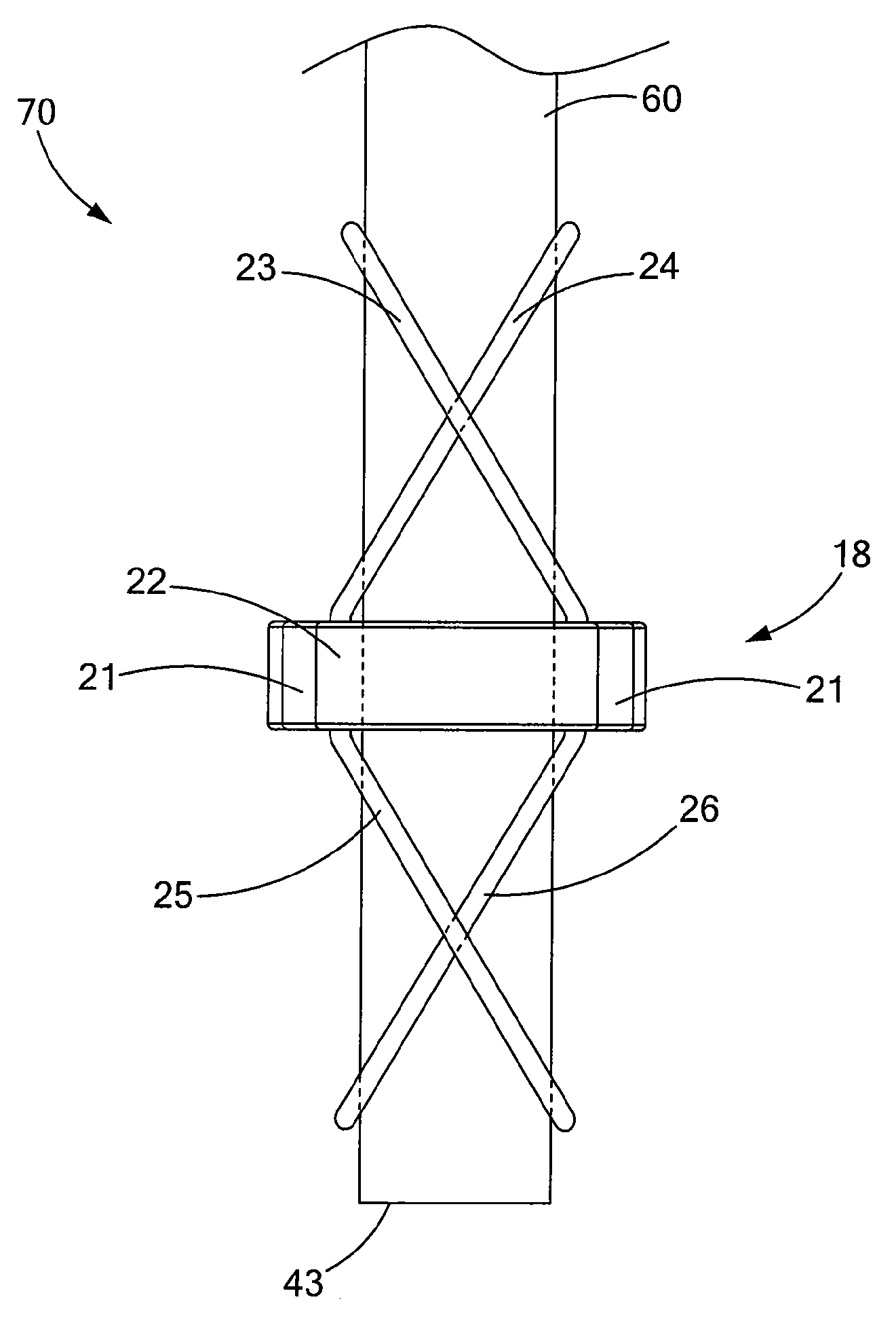 Linear clamps for anastomosis