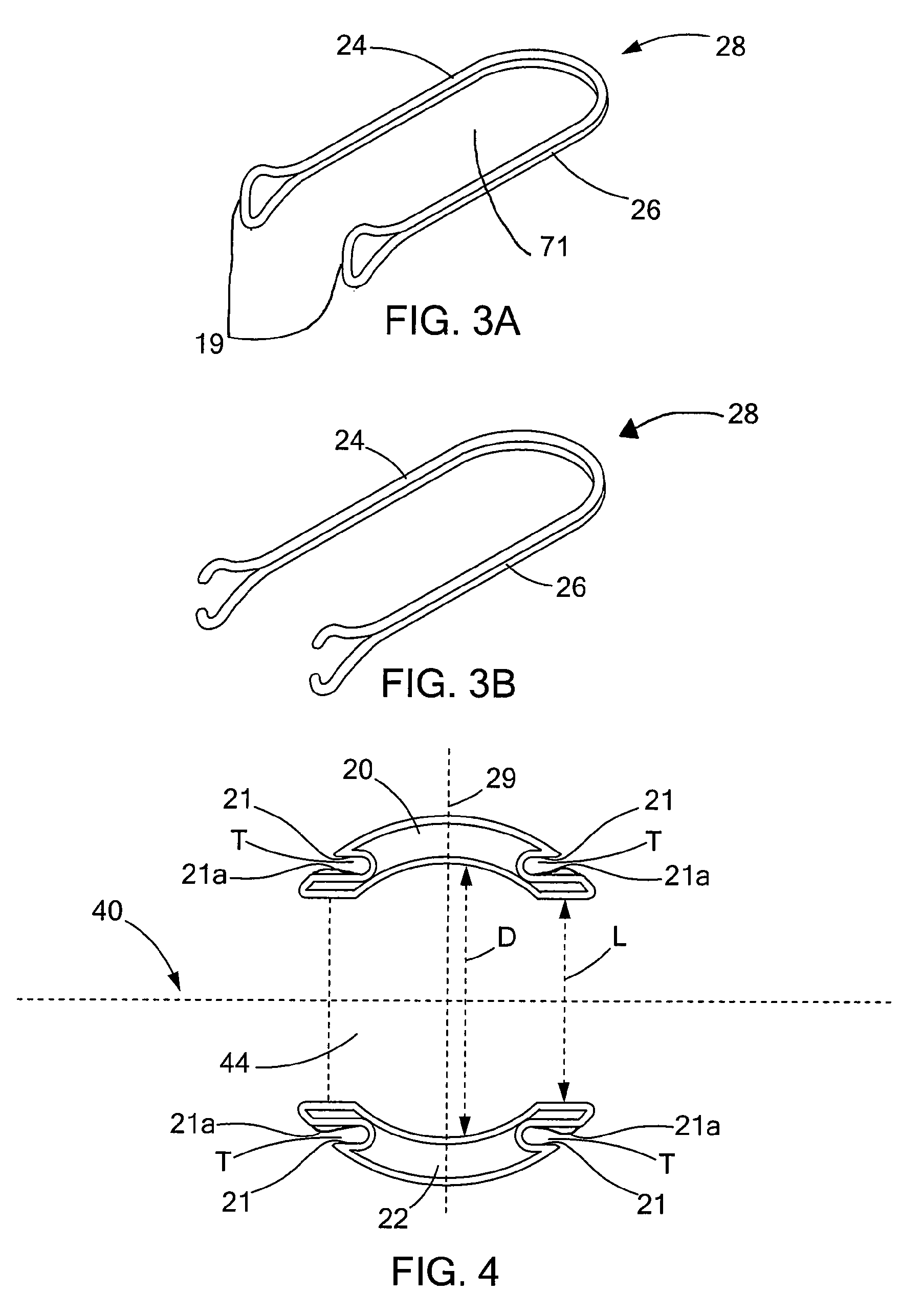 Linear clamps for anastomosis