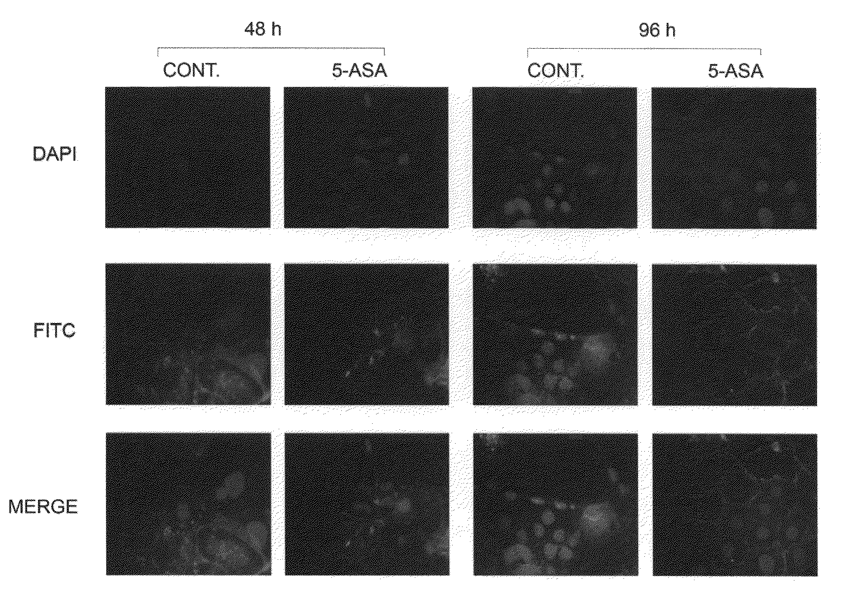 Determination of 5-ASA efficacy in CRC prevention and/or treatment by gene expression analysis