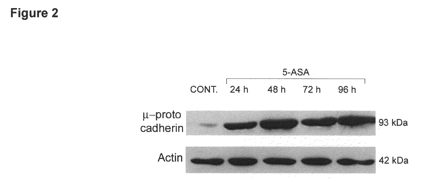 Determination of 5-ASA efficacy in CRC prevention and/or treatment by gene expression analysis