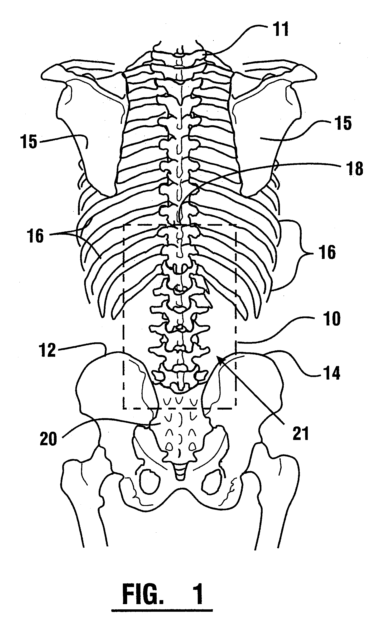 EMG Diagnostic System and Method