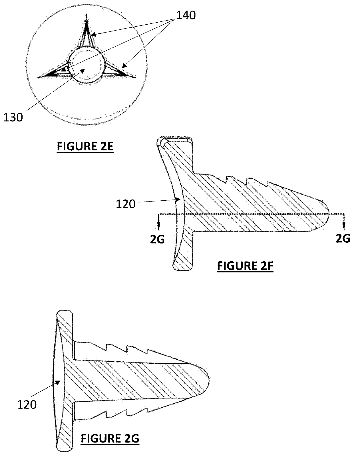 Motion toe systems and methods