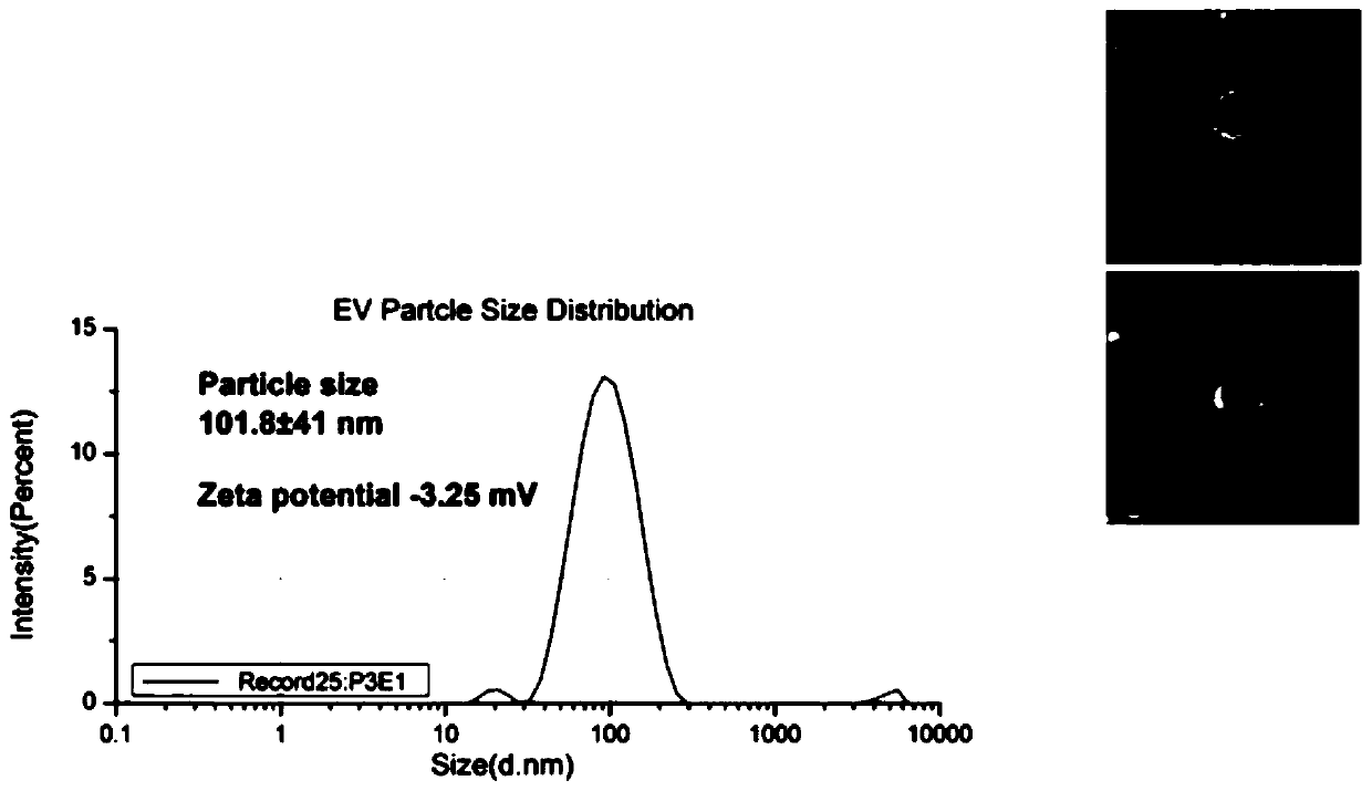 Method for simultaneously detecting protein, RNA and exosome membrane protein in exosome