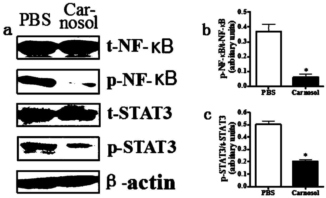 Application of carnosol in preparation of medicines for preventing and treating experimental autoimmune encephalomyelitis