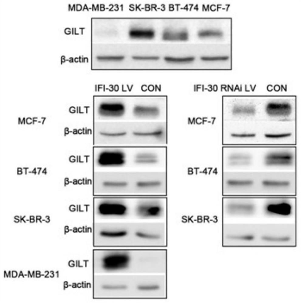 Application of protein/gene IFI30 related to occurrence and development of breast cancer