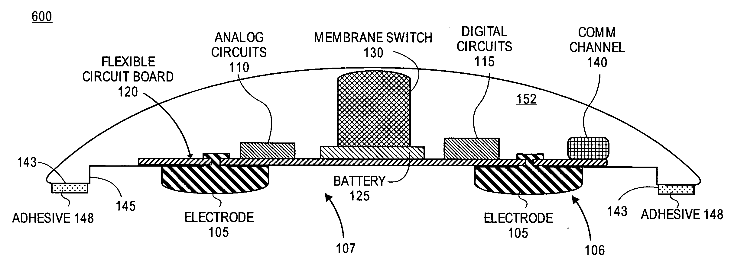 Non-invasive cardiac monitor and methods of using continuously recorded cardiac data