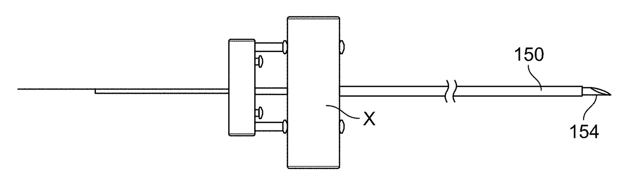 Apparatus and method for positioning, implanting and using a stimulation lead