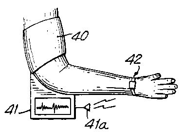 Portable blood pressure measurement device and blood pressure measurement method