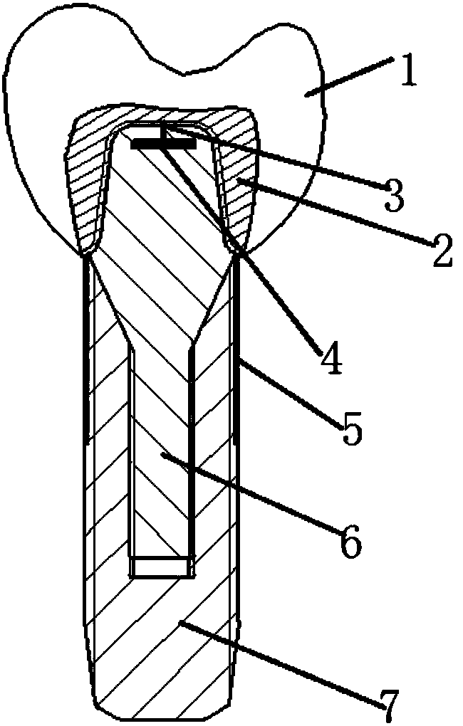 Sensing system and method for detecting 3D printing implant tooth biting force