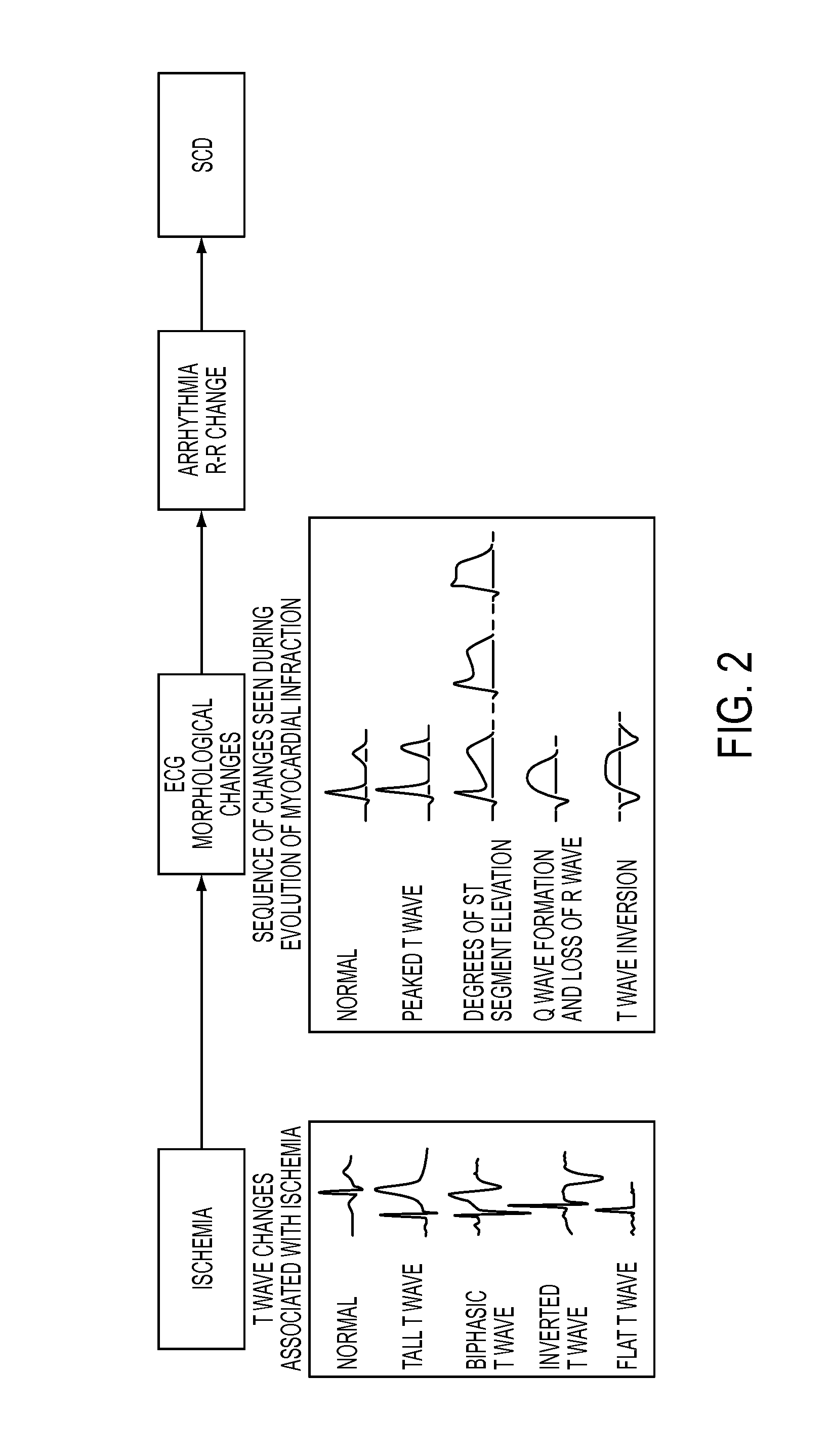 Method and device for early detection of heart attack