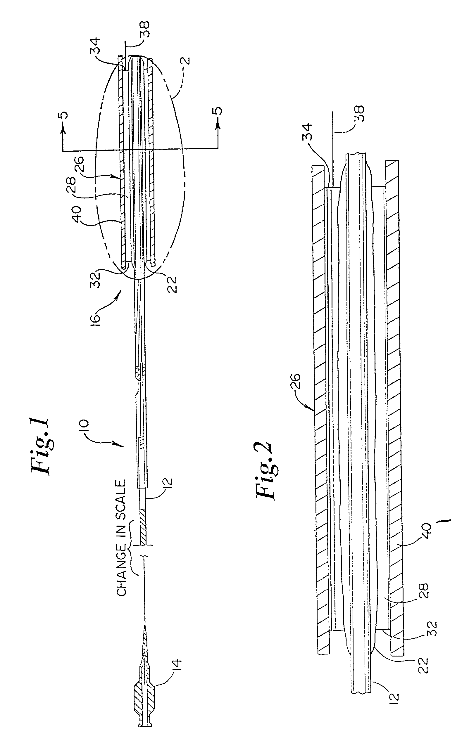 Catheter with removable balloon protector and stent delivery system with removable stent protector