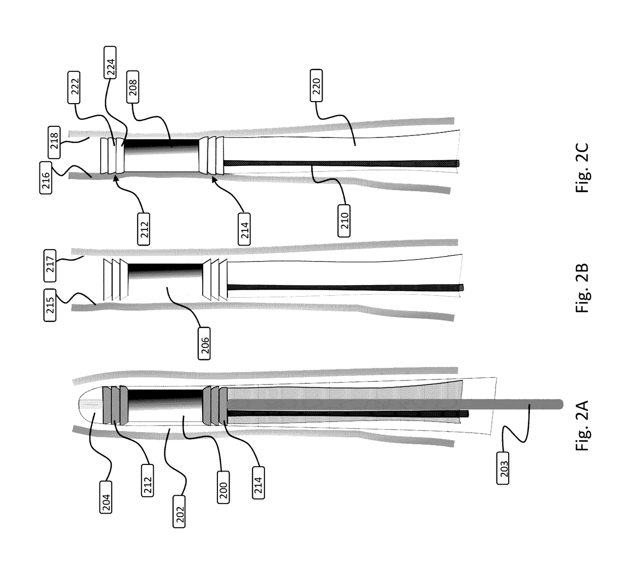 Devices and methods for anchoring a sheath in a tissue cavity