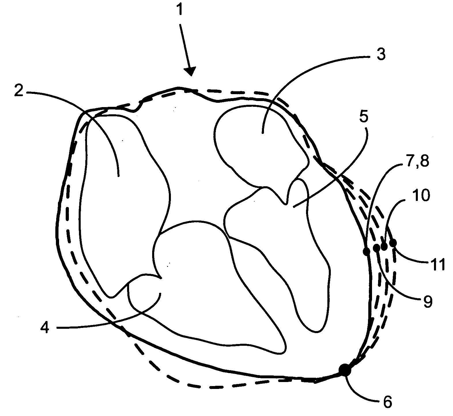 Method and system for measuring in a dynamic sequence of medical images