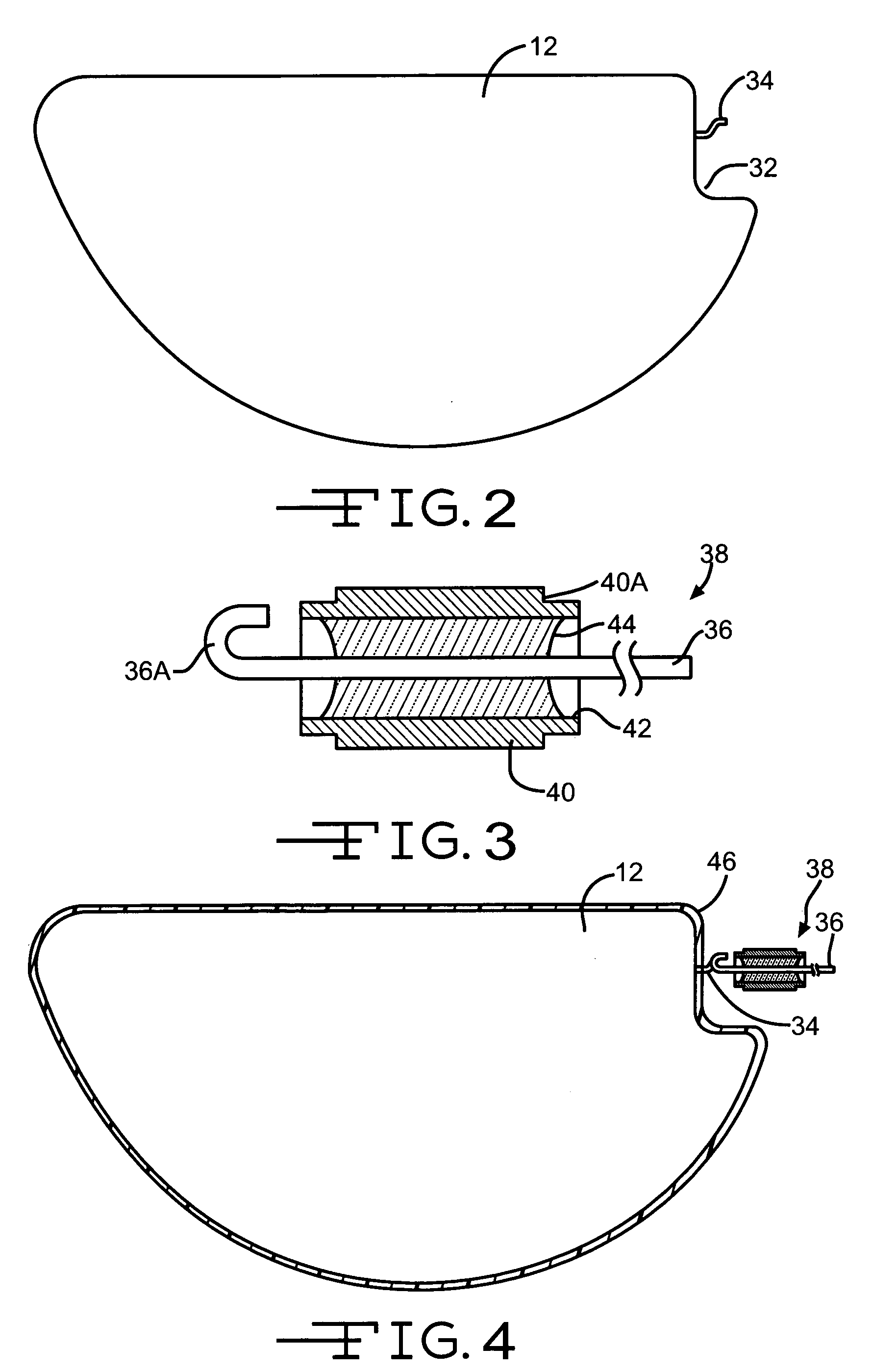 Molded polymeric cradle for containing an anode in an electrolytic capacitor from high shock and vibration conditions