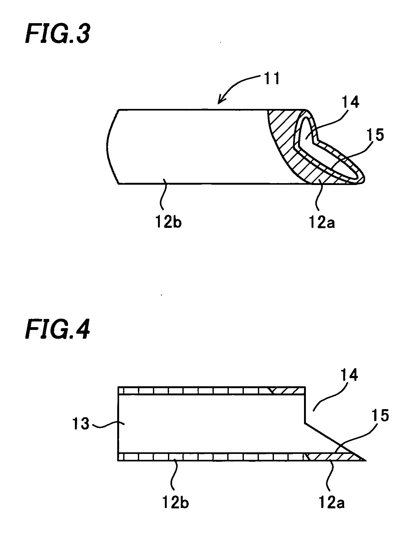 Suction tip for dental treatment