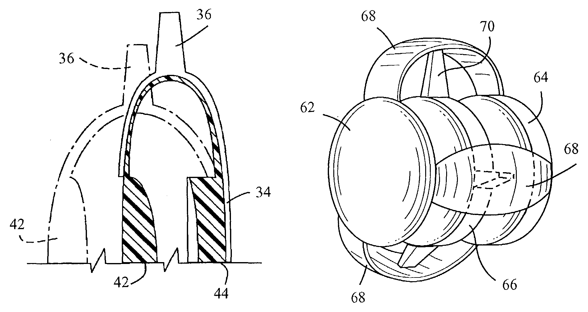 Haptics for accommodative intraocular lens system