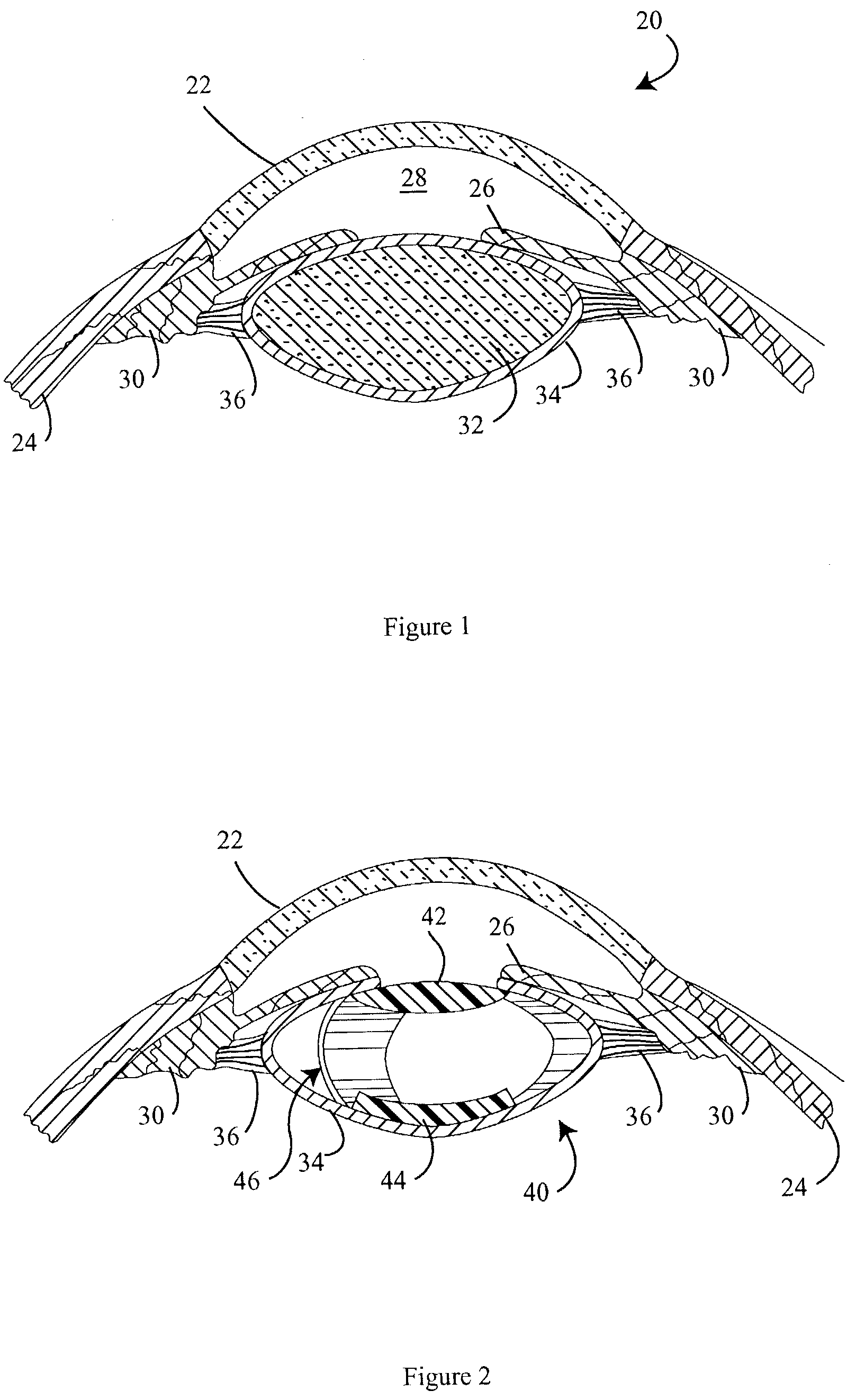 Haptics for accommodative intraocular lens system