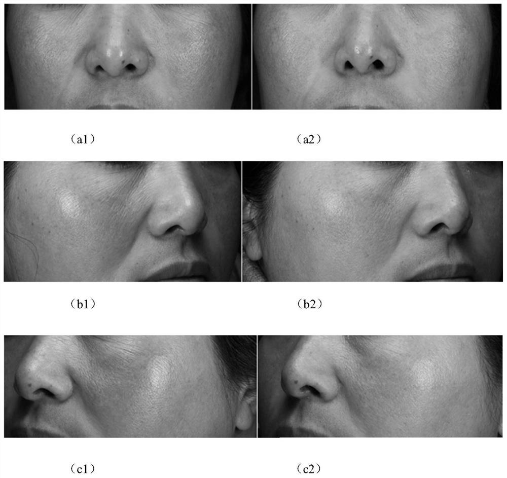 Multi-effect anti-aging skin care product and preparation method thereof