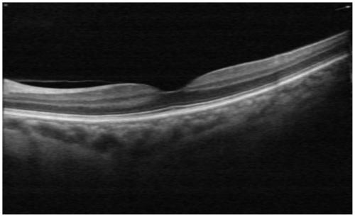 OCT fundus image semi-automatic segmentation method and device based on curve group matching